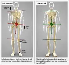 Illustration of foot alignment